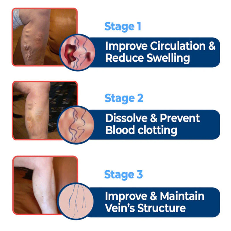 BBOJI™ Vein Dredge Silkworm Extract Spray 🌿✨ - Relief for Varicose Veins & Better Circulation 💪💧