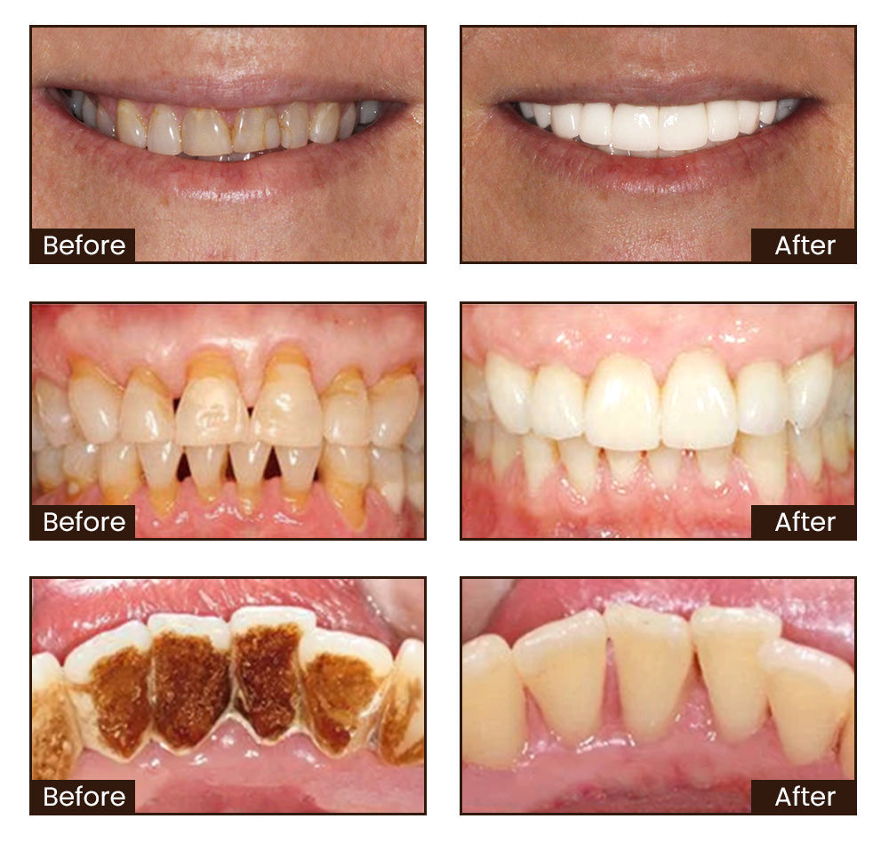 LOVILDS™ Nicotinamide Whitening Toothpaste