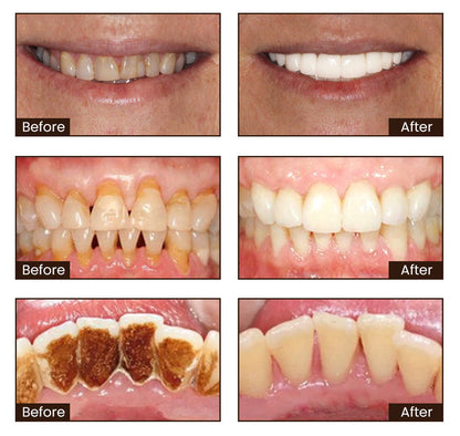 LOVILDS™ Nicotinamide Whitening Toothpaste