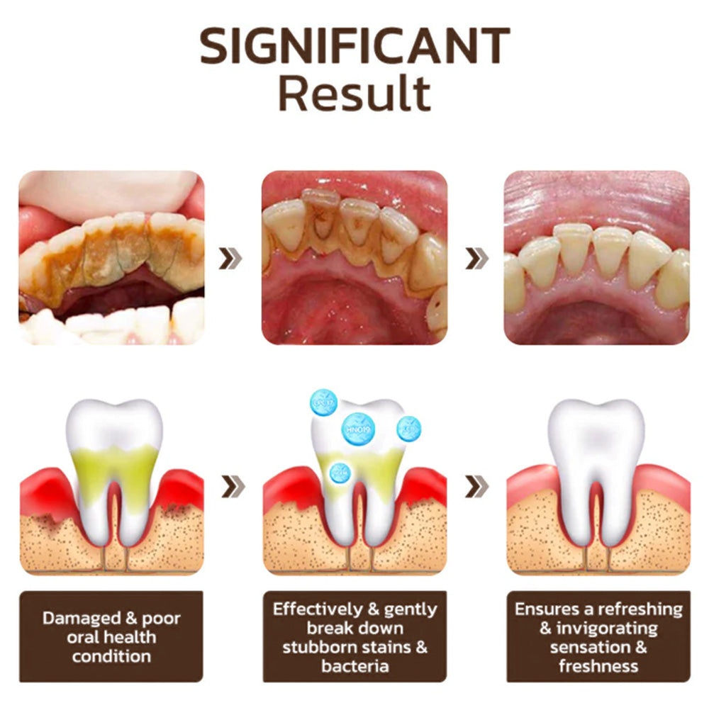 LOVILDS™ Nicotinamide Whitening Toothpaste