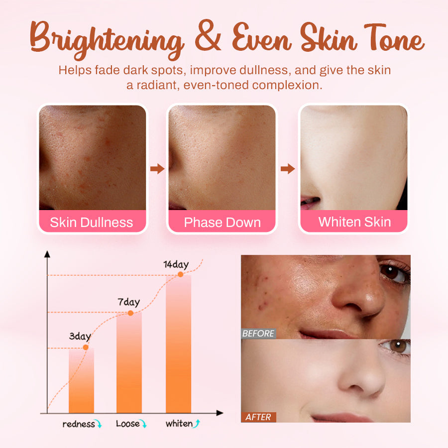 LOVILDS™ Whitening and Freckle - Removing Mask