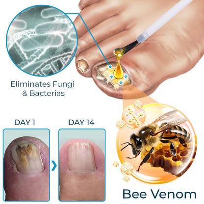 LOVILDS™ Bee Venom Deep Repair Nail Essence 🐝✨ | Powerful Antifungal & Nail Strengthening Solution 💪🌱